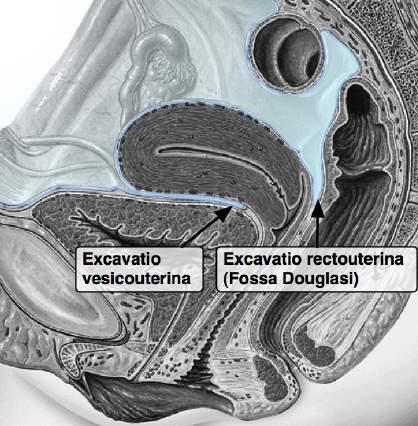 sacrospinosus och Spina ischiadica Superiort: Lig. sacroiliaca ant. Foramen ischiadicum majus Bildas av incisura ischiadica majus, lig. sacrospinale & lig. sacrotuberale. Här går m. piriformis ut!