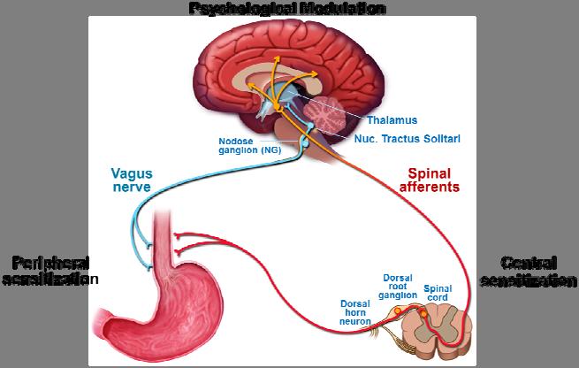 Visceral hypersensitivitet Ascending