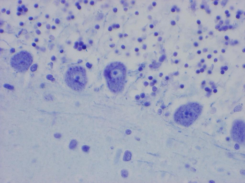 Cerebellum: