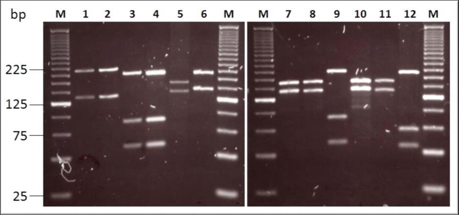 Molekylära metoder 1. Detektion av Leishmania-DNA 2.