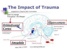 Klassifikation av dissociativ störning: Hypnosövning det snälla djuret Akut stress PTSD Komplex PTSD Traumarelaterad BPD