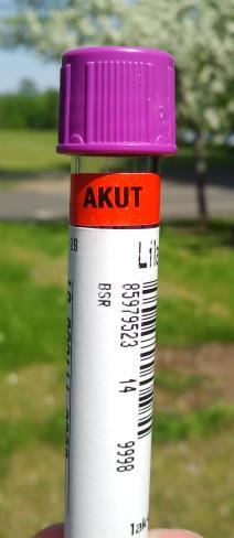 Akuta prover: Akuta prover märks med etikett AKUT, etiketten ska sitta högst upp på röret. (Obs! Aldrig över streckkod!). AKUT etikett finns att beställa på Marknadsplatsen artnr.102 729 001.