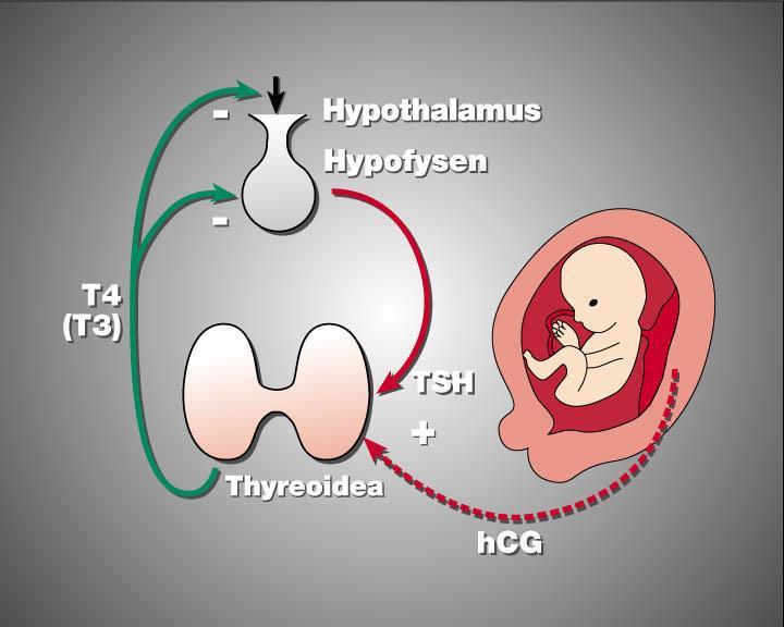 HYPERTYREOS OCH GRAVIDITET 0,4 % hypertyreos 0,6 % subklinisk hypertyreos Gestationell tyreotoxikos, HcG TRAK struma? ögon? arv?