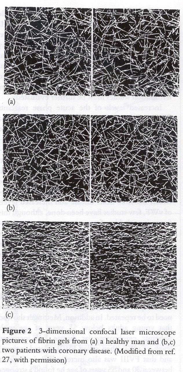 permeabilitetskonstant Ks Ks = 10.