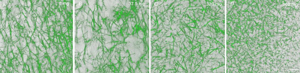Effekt av acetylsalicylsyra (ASA) på fibrin struktur hos friska individer Confocal 3D microscopy fibrinbilder utan (a); med 37.