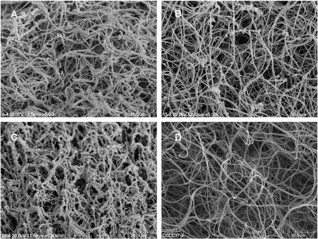 SEM bilder av fibrin i plasma från 3 patienter med RA (A-C) and 1