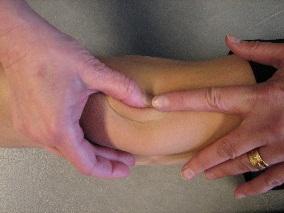 extenderade knäleder (stående) Höftled Passiv abduktion över 85 grader (liggande) Knäskål Till/över medellinje i medial/lateral riktning (liggande) v Knäled (ext)passiv knäextension över 10 grader