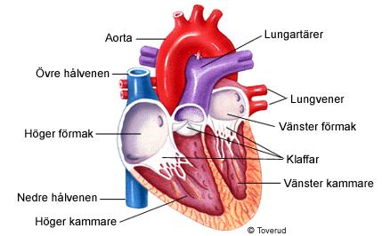 Secondary Volume depletion 3 Brady Sick sinus AV-block Tachy VT Inherited SVT 4