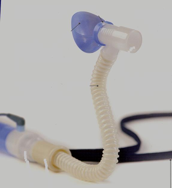 OPTIFLOW TRACKANSLUTNING I samband med ventilatorurträning är Optiflow via trakeostomi förstahandsval, istället för så kallad tracknäsa.