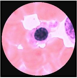 Ortokromatisk erythroblast Retikulocyt K: schackbräde,