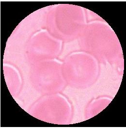 celler D: 7-8 μm Ö: polykromatofila erythrocyter F = form