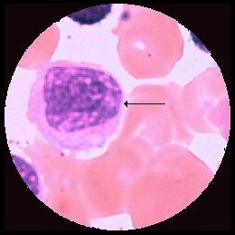 Hemocytoblast Myeloblast Promyelocyt ojämn kontur, oval K:, lucker,
