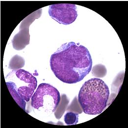 Hemocytoblast Myeloblast ojämn kontur Monoblast Promonocyt, oval K: rödtonad,