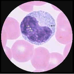 15-20 μm F = form Monocyt K = kärna C = cytoplasma D = diameter K: kromatin ger