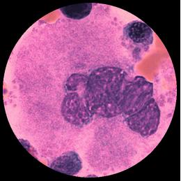 = form Trombocyt K = kärna C = cytoplasma D = diameter F: