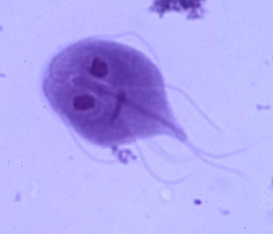 Cyclospora cayetanensis Cilosphora (Balantidium coli) Patogena?