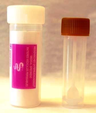 Diagnostik tarmprotozoer- PCR PCR-paket (fecesburk utan tillsats) Entamoeba histolytika Entamoeba dispar Cryptosporidum parvum/hominis Giardia intestinalis (duodenalis) Dientamoeba fragilis (vid