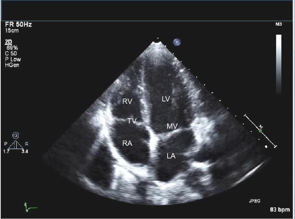 Focused cardiac ultrasound/fickultraljud Undersökningstid erbjuds samma dag, referensmetod