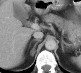 KH37 Adrenal