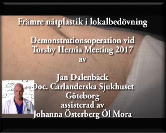 dietistkontakt för vikreduktion inför ärrbråckskirurgi Jan Dalenbäck Pär Sven
