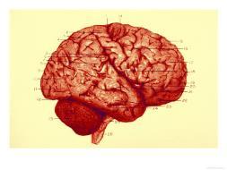 Vanliga symtom vid stroke höger hjärnhalva/ icke-dominant hemisfär
