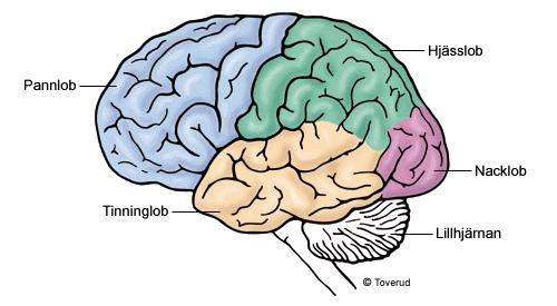 Kroppsuppfattning Neglekt (förnekande) Neglekt Vanliga symtom vid stroke