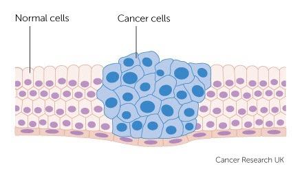 46 % FRÅGA 4 VAD ÄR CANCER?