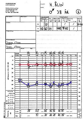 Exempel 6 Maximalt ledningshinder vilket betyder 60 db. En miljondel av ljudenergin (10-6.