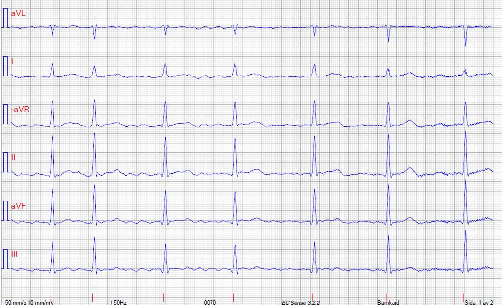 EKG 2015