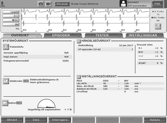2. Välj PSA-knappen för att aktivera PSA-funktionen (Figur 2 på s. 12). NOTERA: När PSA-programmet har startat fortsätter det att vara påslaget tills programmeraren stängs av. 3.