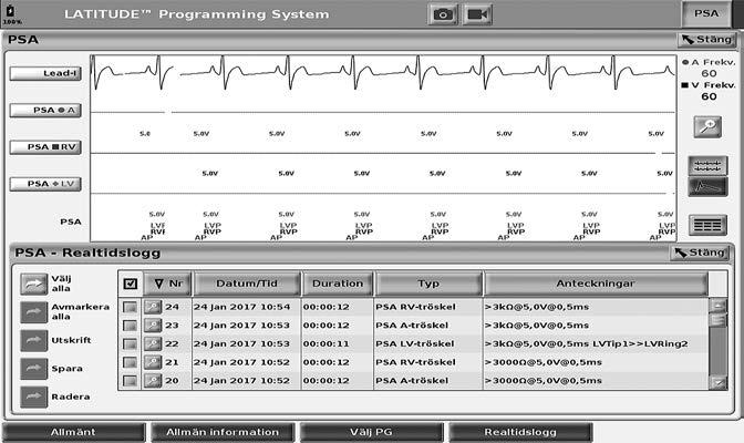 PSA-programmet är igång REALTIDSLOGGAR Använd de två knapparna för skärmkopia och
