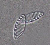pediculus, Cocconeis placentula (Figur 4), Gomphonema angustatum, Melosira varians (Figur 7), Navicula antonii, Navicula cryptocephala, Navicula lanceolata,