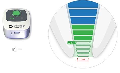 Endodontisk filprogression Färg- och ljudindikering på Propex IQ apexlokalisator och färgindikering i appen Endo IQ Koronalt område till referenspunkten för identifiering av arbetslängd.