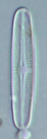 10 µm 10 µm Figur 16: