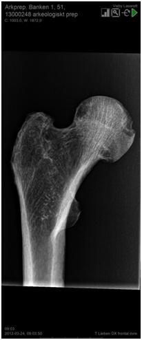 Bild A4: Röntgenbilder från grav 51.