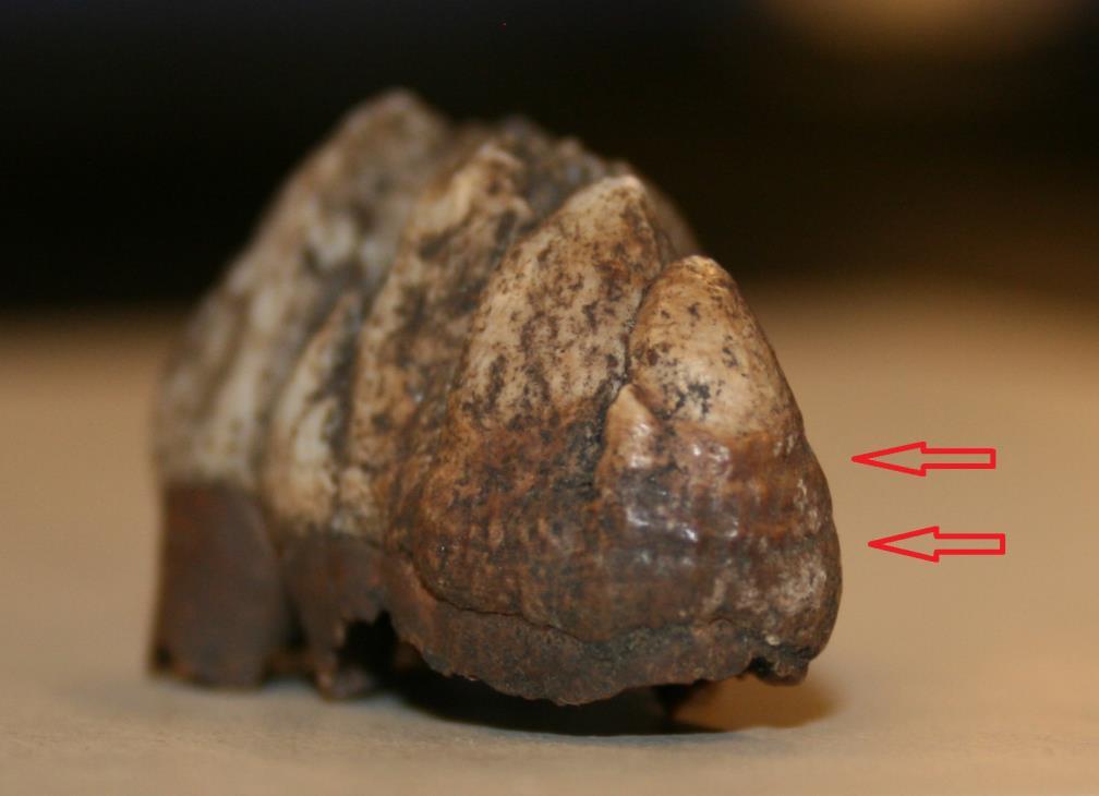26), en M3:a i underkäken (Fig.