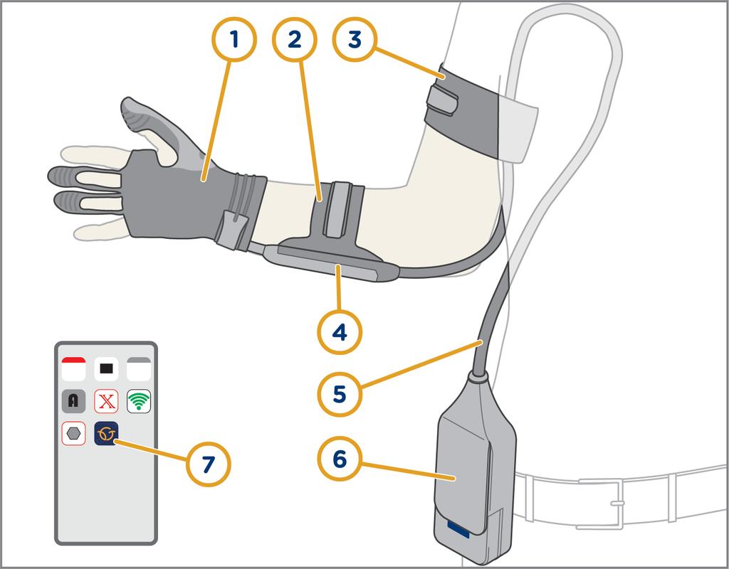 Om produkten 1.5 1.5.1 Produktöversikt Carbonhand Figur 2: Carbonhand handske och enhet.