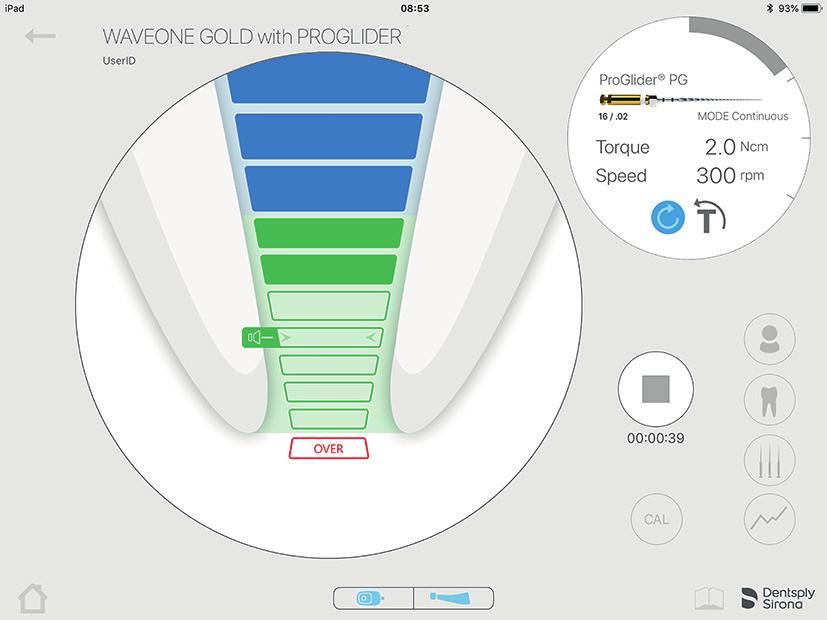 B Behandlingsskärm i ej anslutet läge (Gäller endast Propex IQ apexlokalisator) Filprogression C Behandlingsskärm i anslutet läge med X-Smart IQ handenhet Information X-Smart IQ handenhet Skapa eller