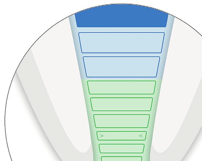 E Anpassa Propex IQ apexlokalisator visualisering Utför alltid testet i stängd krets innan du utför en behandling. (se avsnitt 3).