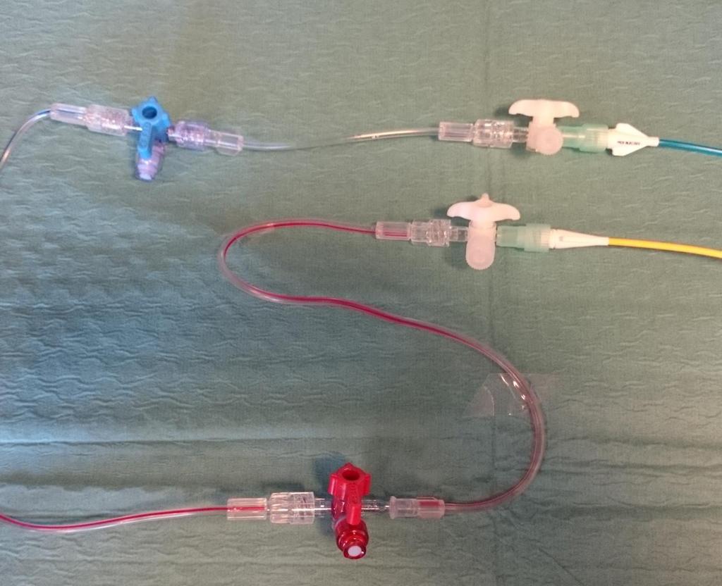 Bilaga 5 Tryckset för kontinuerligt CVT kopplas till proximala lumen på PA-katetern.