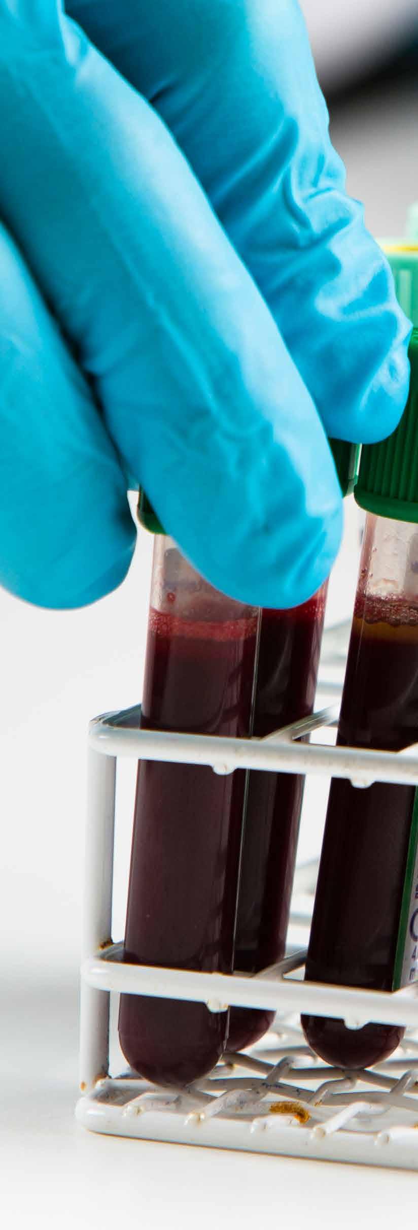 Marknad Akutmottagningar inom EU och i USA bedöms utgöra HemChecks kärnmarknad. Där genomförs varje år cirka 65 miljoner blodprover som är relevanta för produktkonceptet anpassat till blodprovrör.