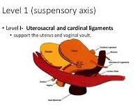 Level I - suspension Vaginaltoppen är upphängd åt sidorna i