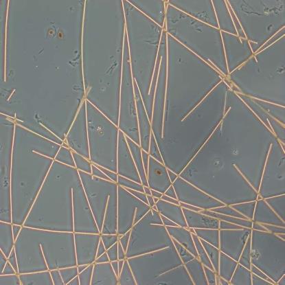 Bakgrund Cyanobakterier kan bilda cyanotoxiner Cyanobakterier är mikroskopiska organismer som finns naturligt i ytvatten. Tidigare har cyanobakterier kallats blågröna alger.