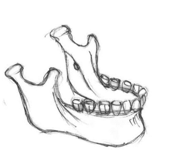 Maxilla Detta ben består av en central del, varifrån fyra utskott utgår: processus frontalis mot os frontale, processus zygomaticus mot okbågen, processus alveolaris med sina alveoli dentales för