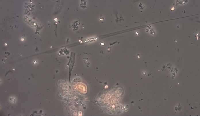Växtplankton Växtplankton är mikroskopiskt små primärproducenter som svävar fritt i vattnet. Artsammansättningen speglar vattnets fysikaliska och kemiska sammansättning.