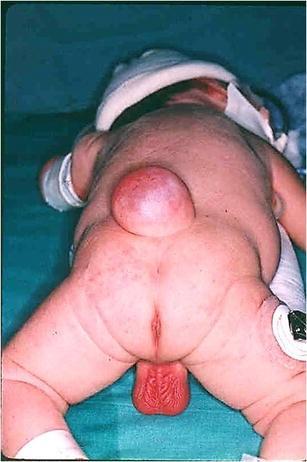 Spinal