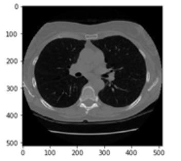 3 Metod I detta kapitel beskrivs tillvägagångssättet för genomförandet av vår studie. För att kunna jämföra resultat från användandet av lung-segmentering har en experimentmetodik använts.