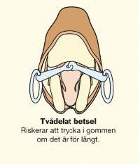 Hästens mun Hästens mun är känslig för skav och tryckskador och bör kontrolleras ofta. Även grundligare undersökningar bör göras emellanåt av tandvårdskunnig veterinär.