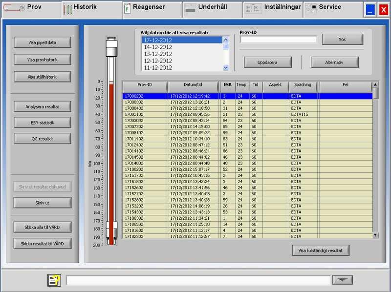 Interrliner programvara 5.3.5.7. Visa provhistorik (QC) Denna skärm visar alla patientresultat som har uppmätts efter valt QC-resultat och upp till påföljande QC-resultat.