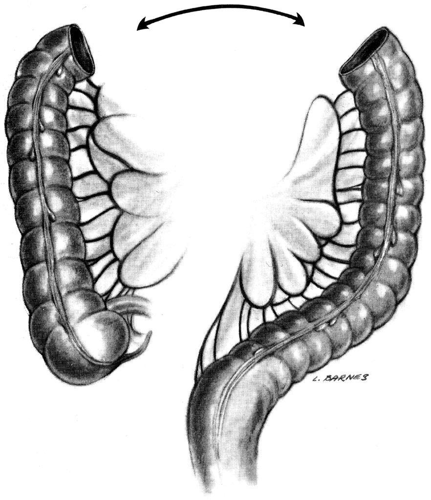 Transversum